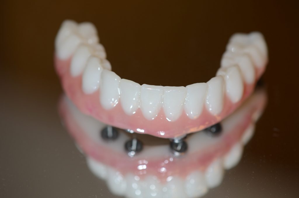 Final Zirconia Bridge