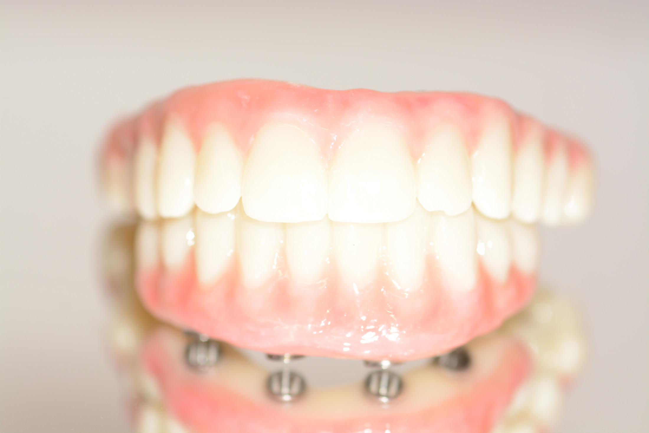 Photos Alpharetta GA, S2 Digital Dental Lab