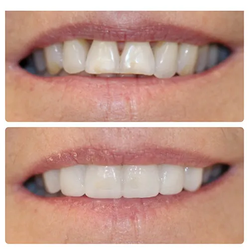 polycarbonate mockup before and after