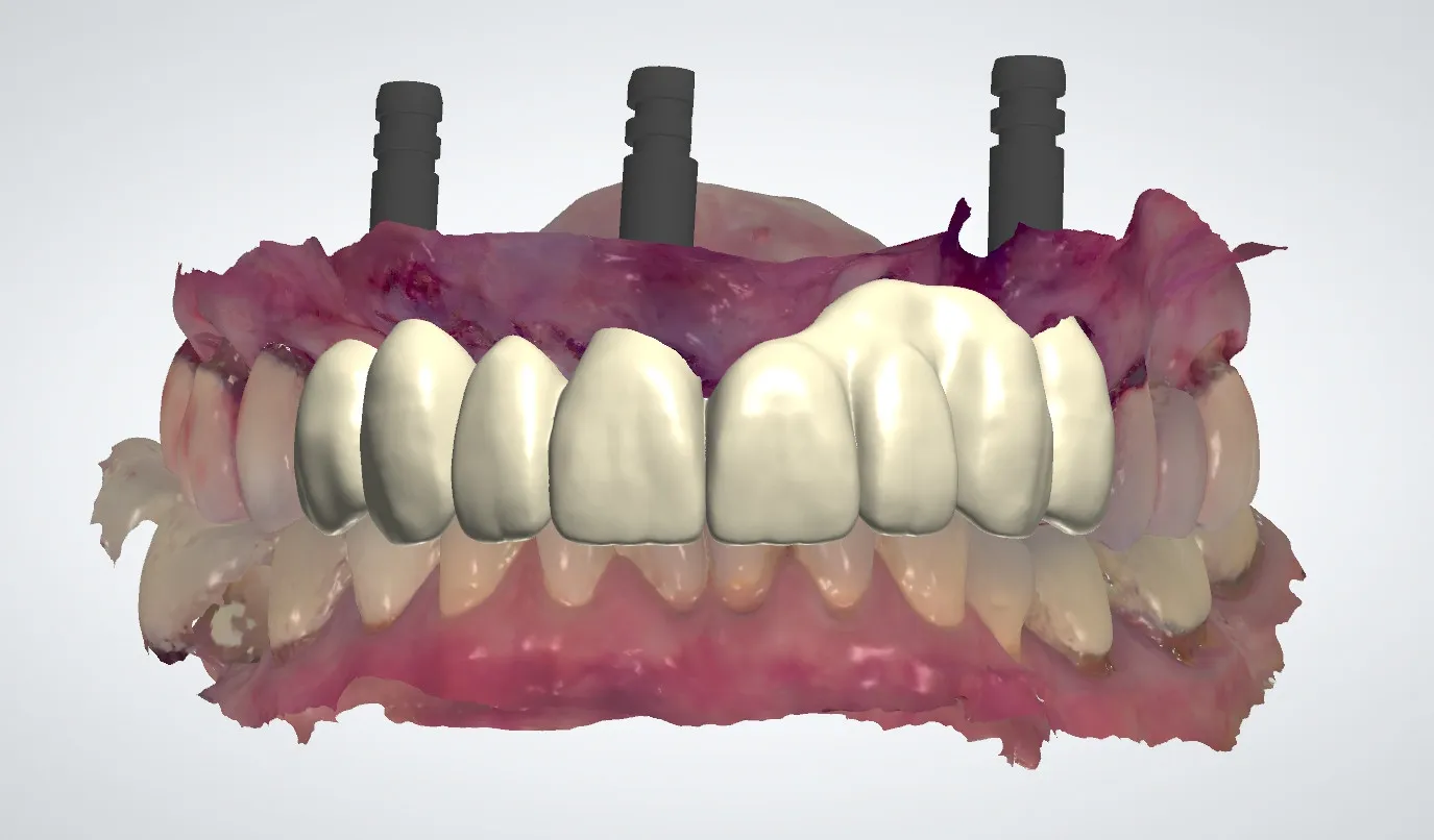 Diagnostic Services Alpharetta GA, S2 Digital Dental Lab