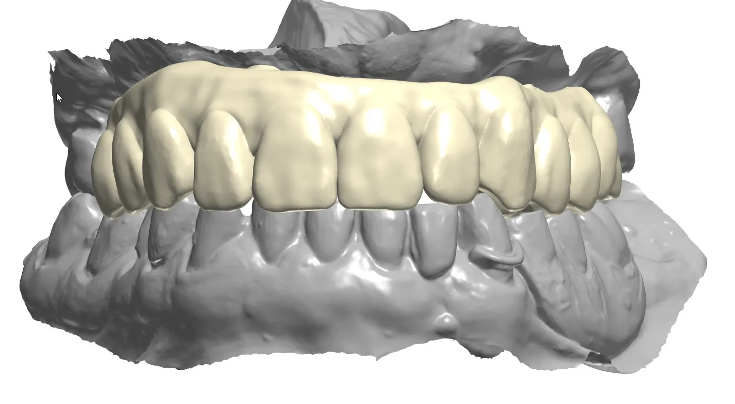Diagnostic Services Alpharetta GA, S2 Digital Dental Lab
